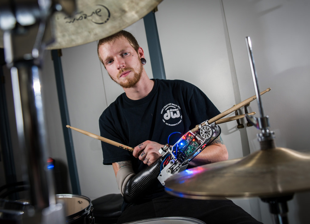 A drummer plays the drums using the Robotic Drumming Prosthesis.